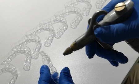 Reinigung transparenter Zahnschienen