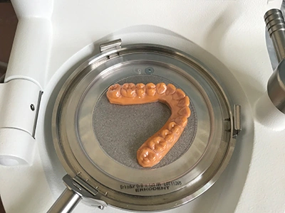 Maßangefertigung von Retainern